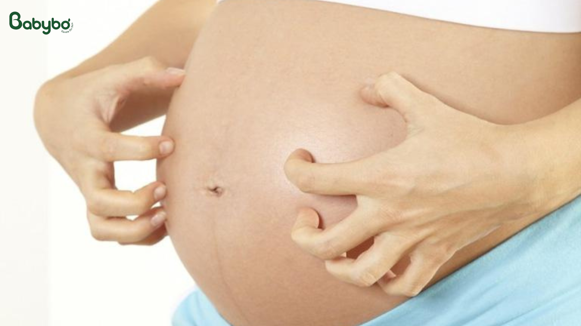 Mẹ bầu bị ngứa bụng do da căng và rạn da thai kỳ